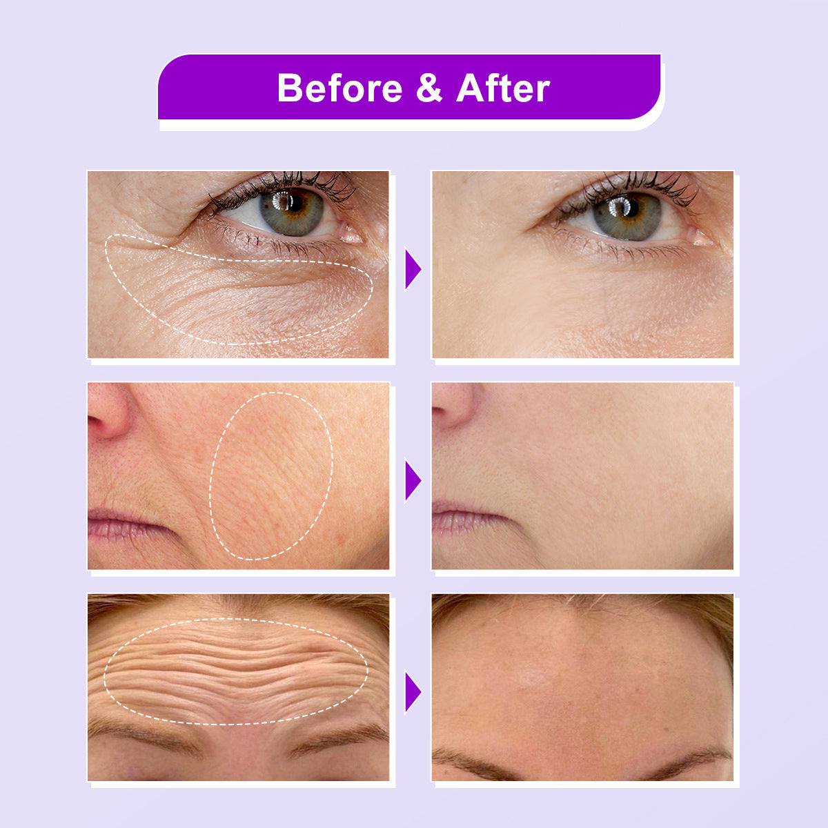Facial Skin Moisturizing Lotion Soft